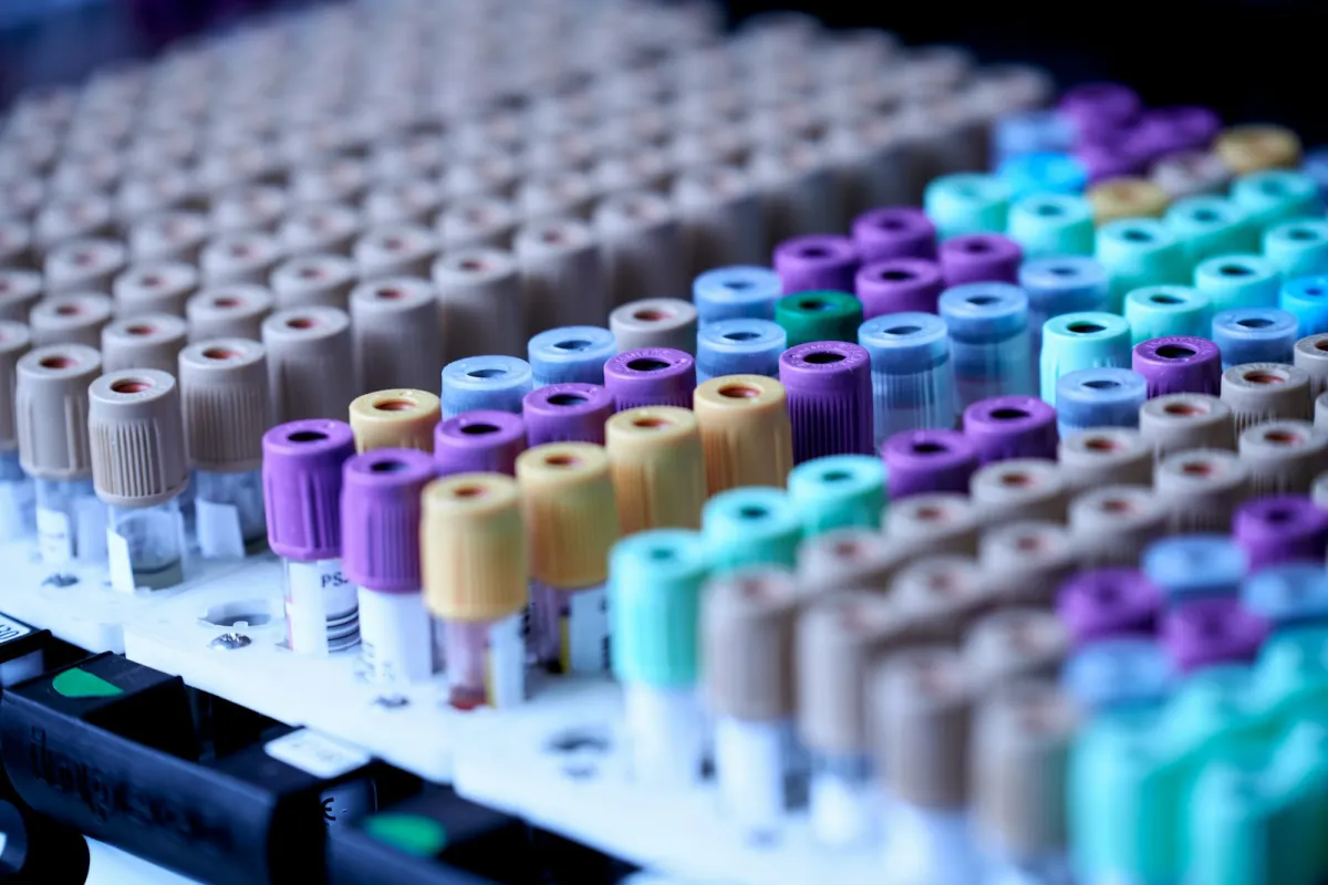 Rows of sample tubes with coloured caps in a laboratory rack