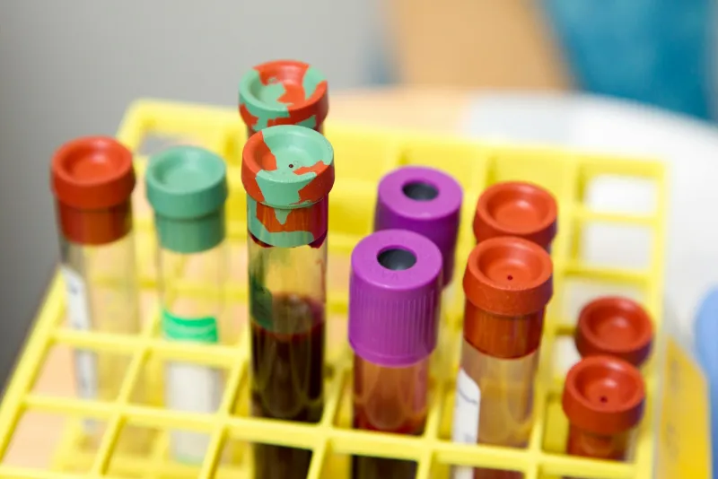 Sample tubes with coloured caps standing in a yellow rack