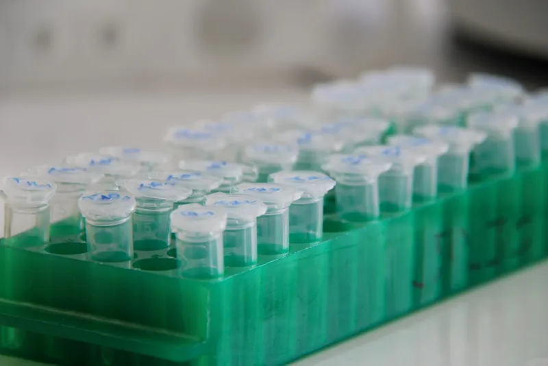 Rows of capped sample tubes in a green laboratory rack
